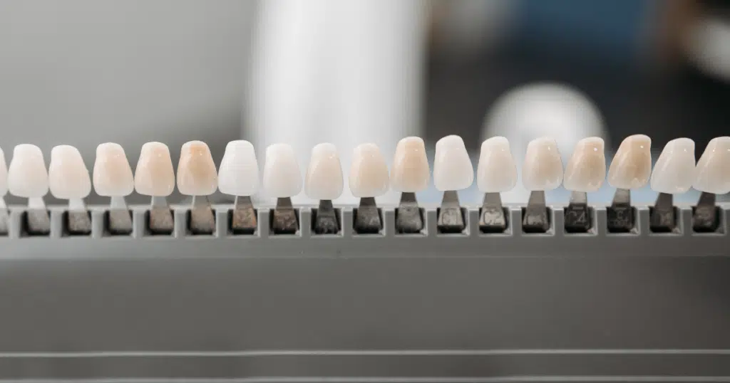 Dental Veneers - Summit Dental Doylestown - featured image
